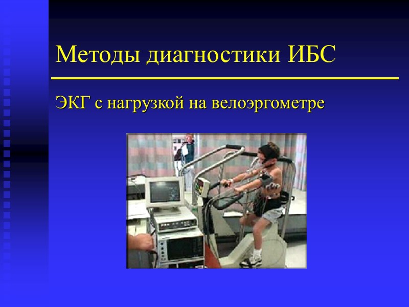 Методы диагностики ИБС ЭКГ с нагрузкой на велоэргометре